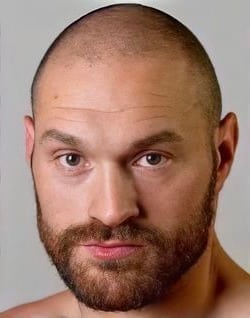 Tyson Fury